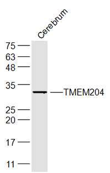 TMEM204 Rabbit Polyclonal Antibody