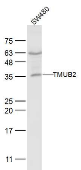 TMUB2 Rabbit Polyclonal Antibody