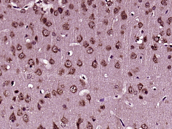 TMX3 Rabbit Polyclonal Antibody