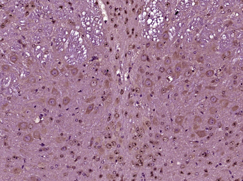 TBC1D13 Rabbit Polyclonal Antibody