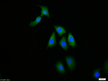 Ubiquitin Rabbit Polyclonal Antibody