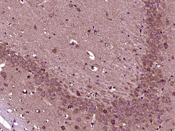 VPS25 Rabbit Polyclonal Antibody