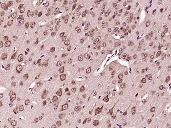 VPS33B Rabbit Polyclonal Antibody