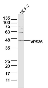 VPS36 Rabbit Polyclonal Antibody