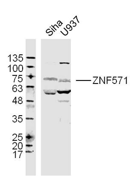 ZNF571 Rabbit Polyclonal Antibody