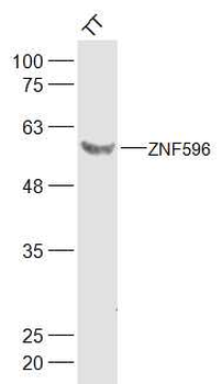 ZNF596 Rabbit Polyclonal Antibody
