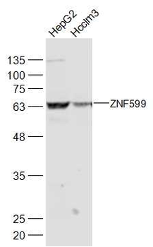 ZNF599 Rabbit Polyclonal Antibody