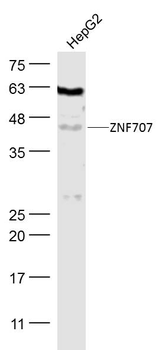 ZNF707 Rabbit Polyclonal Antibody