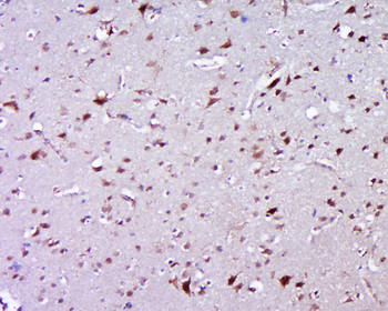 ZNF502 Rabbit Polyclonal Antibody