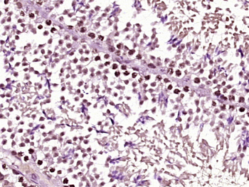 ZNF182 Rabbit Polyclonal Antibody