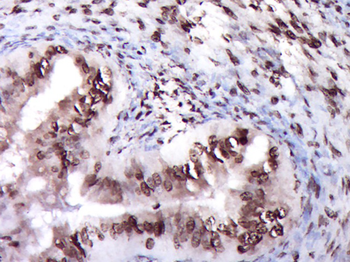ZNF22 Rabbit Polyclonal Antibody