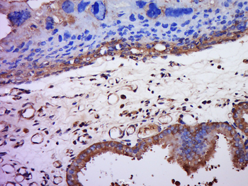 ZP2 Rabbit Polyclonal Antibody