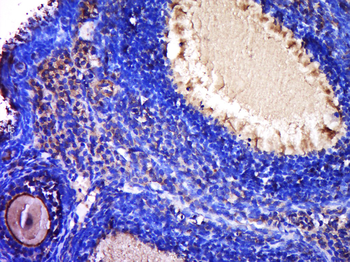 ZP2 Rabbit Polyclonal Antibody