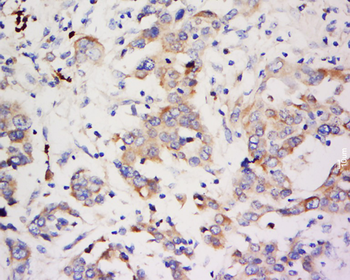 ZNF703 Rabbit Polyclonal Antibody