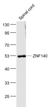ZNF140 Rabbit Polyclonal Antibody