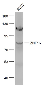 ZNF16 Rabbit Polyclonal Antibody