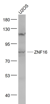 ZNF16 Rabbit Polyclonal Antibody