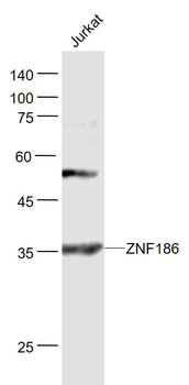 ZNF186 Rabbit Polyclonal Antibody
