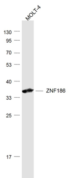 ZNF186 Rabbit Polyclonal Antibody