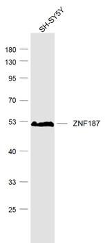 ZNF187 Rabbit Polyclonal Antibody