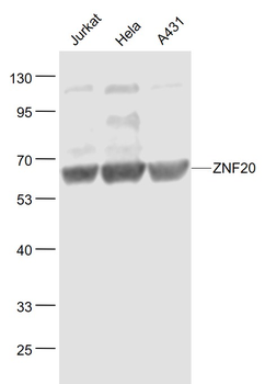 ZNF20 Rabbit Polyclonal Antibody