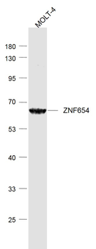 ZNF654 Rabbit Polyclonal Antibody