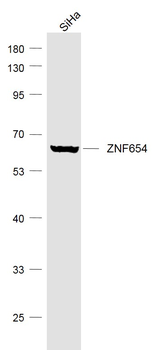ZNF654 Rabbit Polyclonal Antibody