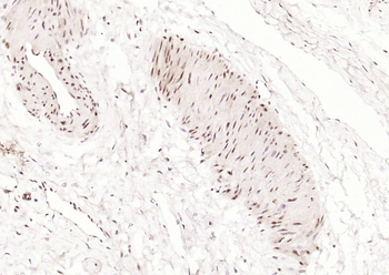 Alx1 Rabbit Polyclonal Antibody