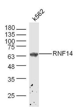 ADAM2 Rabbit Polyclonal Antibody