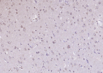 ANKRD54 Rabbit Polyclonal Antibody