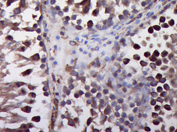 Phospho-Cofilin (Ser3) Rabbit Polyclonal Antibody