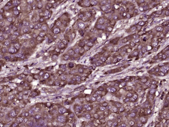 C20orf50 Rabbit Polyclonal Antibody