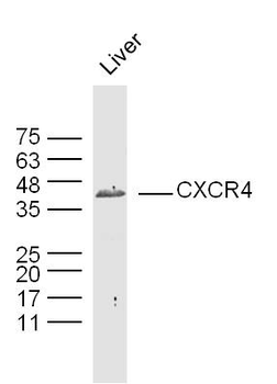 CXCR4 Rabbit Polyclonal Antibody