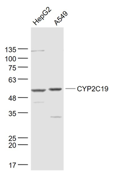 CYP2C19 Rabbit Polyclonal Antibody