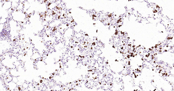 CD68 Rabbit Polyclonal Antibody