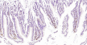 CD68 Rabbit Polyclonal Antibody