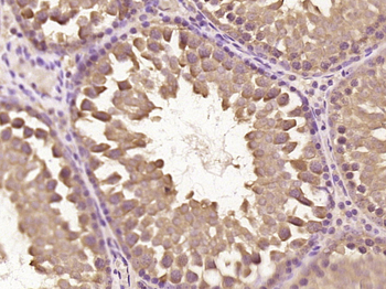 DNPEP Rabbit Polyclonal Antibody