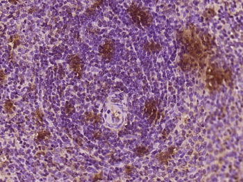 DEF6/IBP Rabbit Polyclonal Antibody