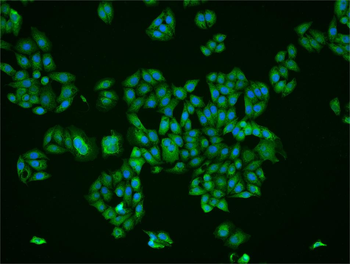 FBP1 Rabbit Polyclonal Antibody