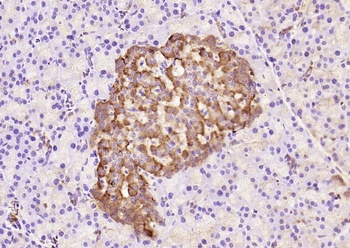 IRS1 (phospho-Ser632) antibody