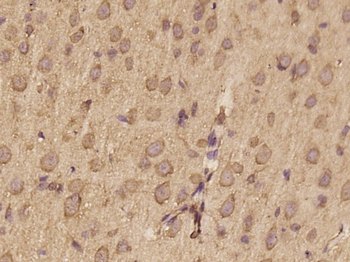 IQSEC3 Rabbit Polyclonal Antibody