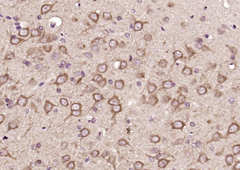 LC3A/B + LC3B + LC3C Rabbit Polyclonal Antibody