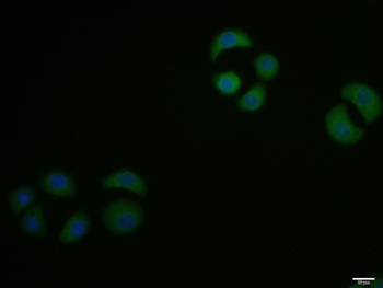 MYPT1 (Phospho-Thr696) antibody