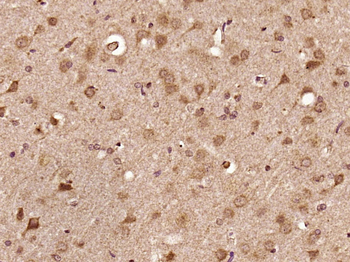 MOG Rabbit Polyclonal Antibody