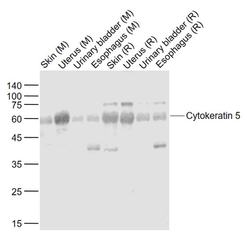 Pan-cytokeratin Rabbit Polyclonal Antibody