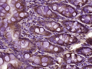 PSTK Rabbit Polyclonal Antibody