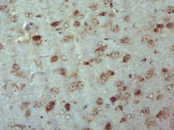 PTPLAD1 Rabbit Polyclonal Antibody