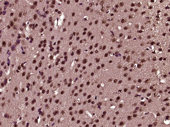 PTPN18 Rabbit Polyclonal Antibody
