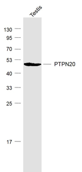 PTPN20 Rabbit Polyclonal Antibody