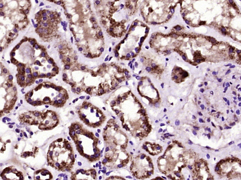 PTPNS1L2 Rabbit Polyclonal Antibody